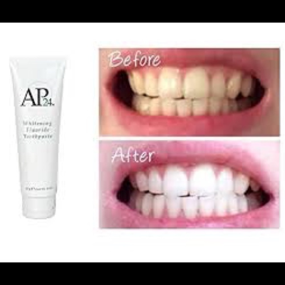 Whitening toothpaste/no trays!!